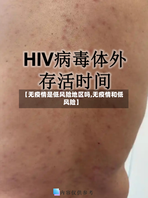 【无疫情是低风险地区吗,无疫情和低风险】-第1张图片